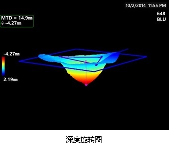 3DPM-深度旋轉(zhuǎn)圖